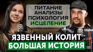 ВРАЧ ВЫЛЕЧИЛА ЯЗВЕННЫЙ КОЛИТ — Тотальное Поражение Кишечника!