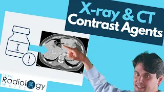 Contrast Agents in X-ray and CT Scans: What You Need to Know