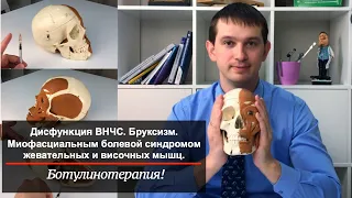 Дисфункция ВНЧС. Бруксизм. Миофасциальным болевой синдромом жевательных и височных мышц.