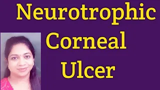 Neurotrophic corneal ulcer// Riley day syndrome/ Management and clinical features.