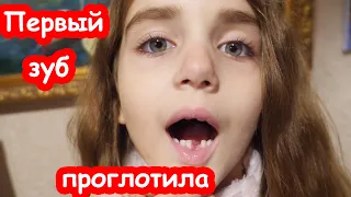 VLOG Алиса проглотила зуб