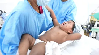 Scared and Shouting Crying Baby Goes under very hard Anesthesia