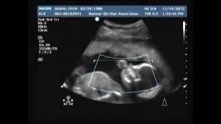 20 week ultrasound.....It's A GIRL!!!!!