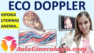 ECO DOPPLER EN OBSTETRICIA: HIPOXIA, ARTERIAS UTERINAS, ANEMIA FETAL... - Ginecología y Obstetricia