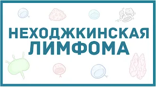 Неходжкинская лимфома - виды, причины, патогенез