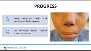 Case reports on Nasal Vestibulitis- Dr Divya Pallavi Ramyead