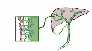 Primary sclerosing cholangitis   causes, symptoms, diagnosis, treatment & pathology