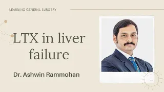 LTx in liver failure   : Dr Ashwin Rammohan