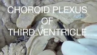 CHOROID PLEXUS OF THIRD VENTRICLE - An educational video