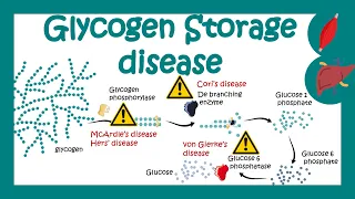 Glycogen Storage Diseases | GSD | Which glycogen storage disorder is most common? | pathology of GSD