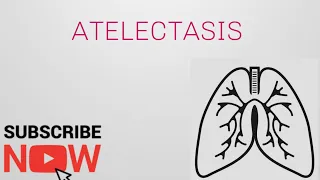 Atelectasis : types and causes