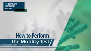 How to Perform the Motility Test