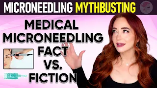 Microneedling MYTHS and FACTS!! My Anti-aging Secret at 47!!