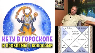 Кету в гороскопе и проблемы с волосами - Василий Тушкин