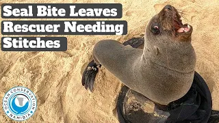 Seal Bite Leaves Rescuer Needing Stitches