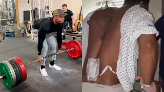 He Broke His Back Deadlifting