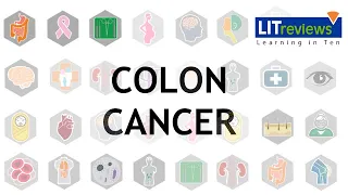 Colon Cancer