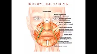 Как убрать носогубные складки. Все о носогубках + упражнения для их коррекции