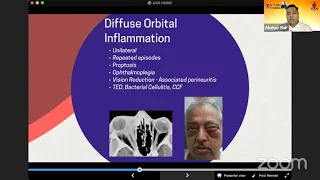 AIOC2021 - IC353 - Topic - Dr  AKSHAY NAIR