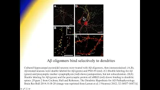 Alzheimer's Disease - Amyloidopathy