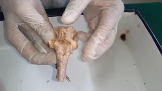 Dissection - External features of brain stem