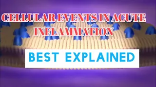 CELLULAR EVENTS OF ACUTE INFLAMMATION ||  PATHOPHYSIOLOGY