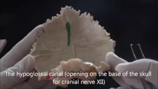 Bones of the skull - The occipital bone - Human Anatomy Video