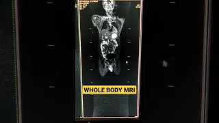 Whole Body MRI #shorts #mri #radiology