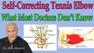 Self-Correcting Tennis Elbow (What Most Doctors Don't Know) - Dr Mandell
