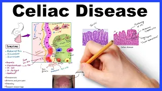 Celiac disease - Pathophysiology, Symptoms, Histology, Diagnosis & Management