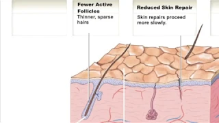 Lecture 7c Dermis, Accessory structures and Aging