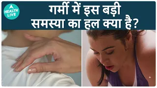 गर्मी मे Muscle Cramps क्यों होता है? | Muscle Cramps | Health Live