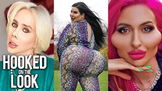 5 Plastic Surgeries That Stunned The World | HOOKED ON THE LOOK