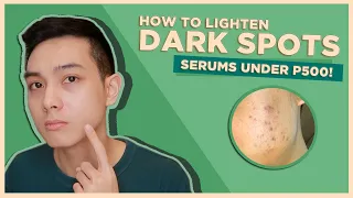 How to LIGHTEN DARK SPOTS + BEST LOCAL SERUMS UNDER P500! | Jan Angelo