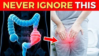 Critical Colon Cancer Symptoms You Should Never Ignore (Must Watch)