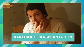 Raymonds Barthaartransplantation | Update nach 4 Monaten