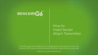 Dexcom G6 -  Inserting the Sensor and Attaching the Transmitter 1