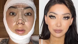 My Facial Plastic Surgery Story! | Dragun
