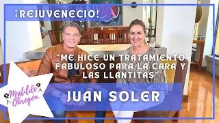 Juan Soler: "Me hice un tratamiento para la cara y las llantitas" I Entrevista con Matilde Obregón.