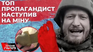 російський пропагандист втратив ногу, бо наступив на війні на російську міну