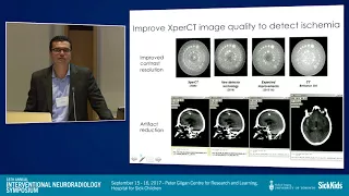 Integrated Stroke Imaging Using a Flatpanel Angiography