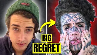 The Boy Who Tattooed His Entire Face & Ended Up Regretting It Big Time