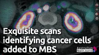 Nuclear medicine funding a win for men with prostate cancer