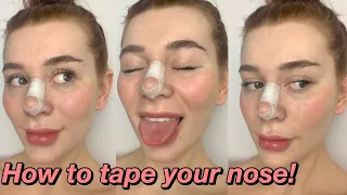 HOW TO TAPE YOUR NOSE AFTER A NOSE JOB! | Rhinoplasty/Septoplasty
