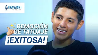 REMOCIÓN DE TATUAJES ¡EXITOSA! | PODCAST | CLÍNICA CHÁVARRI