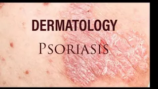 Dermatology - Psoriasis
