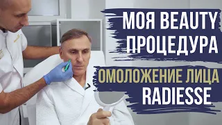 МОЯ BEAUTY ПРОЦЕДУРА👍: ОМОЛОЖЕНИЕ ЛИЦА RADIESSE