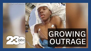 Outrage growing after Kansas City teen shot