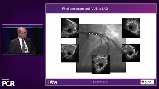 Left main bifurcations: latest clinical data applied to practical cases - EuroPCR 2022