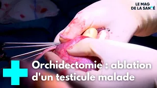 Orchidectomie : une opération pour retirer le testicule malade - Le Magazine de la Santé